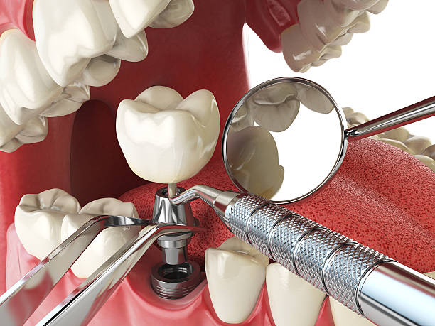 Best Emergency Tooth Extraction in South Rockwood, MI